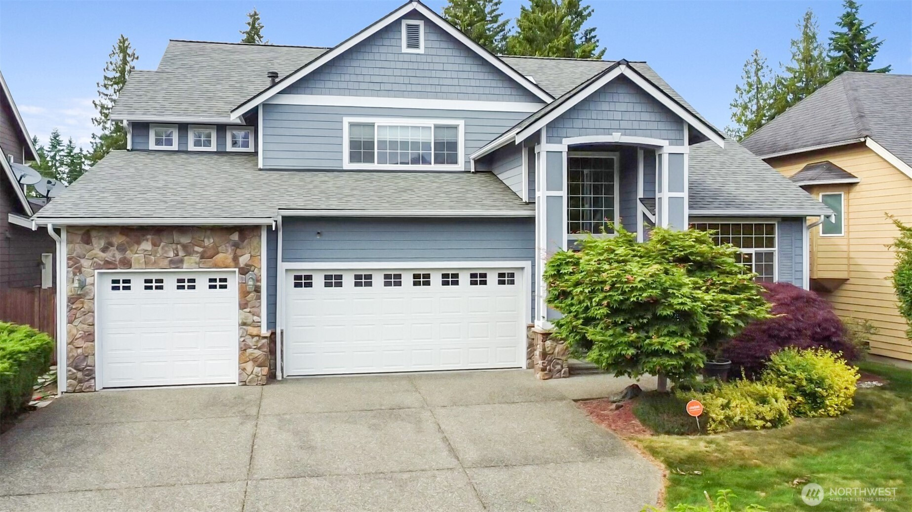 931 196th Place SW, Lynnwood, WA 98036